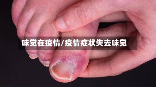 味觉在疫情/疫情症状失去味觉-第2张图片