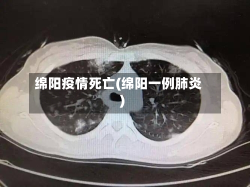 绵阳疫情死亡(绵阳一例肺炎)-第2张图片