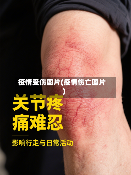 疫情受伤图片(疫情伤亡图片)-第1张图片